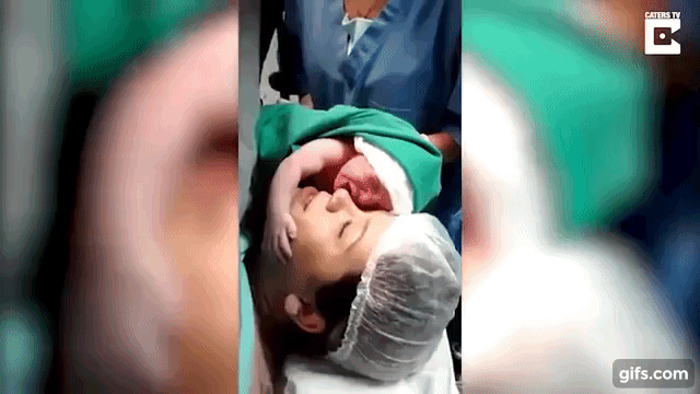 感動映像 産まれた瞬間の新生児がママの顔に抱きついて涙を流す Fundo